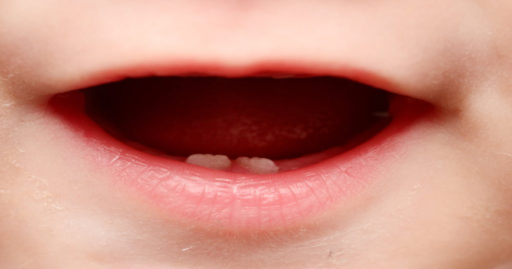 Baby Teeth and Early Oral Care