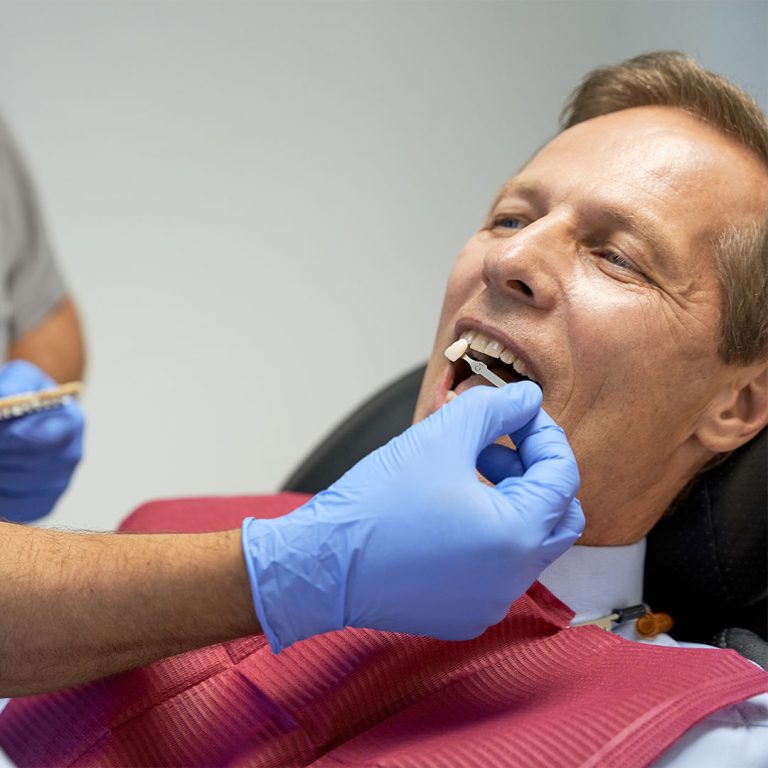 Lost dental crown