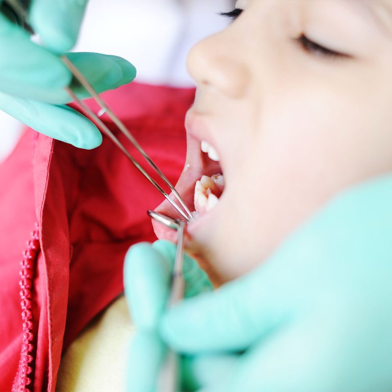 Care for bleeding or swollen gums