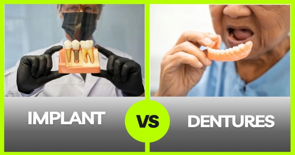 dental implants vs. dentures