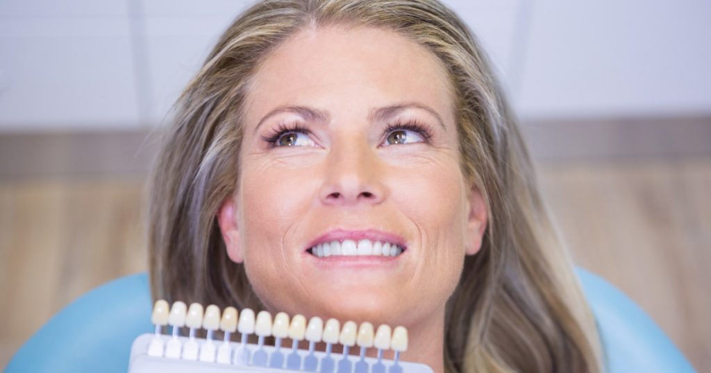 Porcelain Veneers