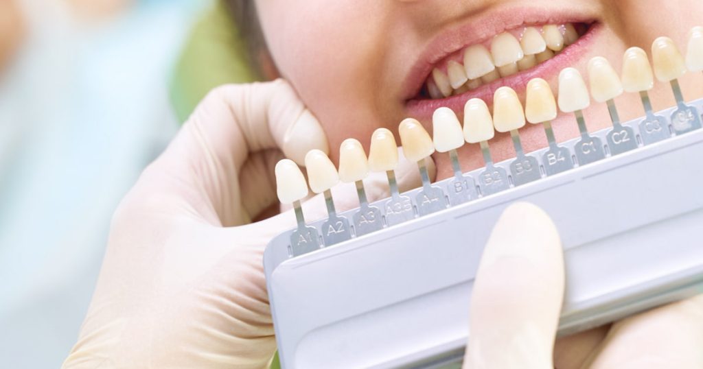 types of dental implants