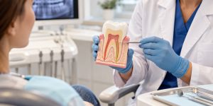 Dentist explaining root canal treatment and aftercare using a tooth model.