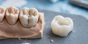 Close-up of a cracked tooth and the dental crown used to protect it